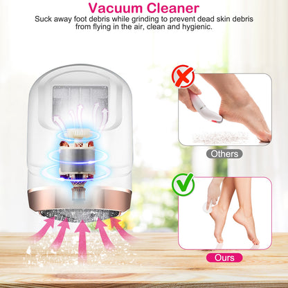 17Pcs Electric Foot Callus Remover With Vacuum Foot Grinder Rechargeable Foot File Dead Skin Pedicure Machine With 3 Grinding Heads 2 Speeds Foot Care Tool